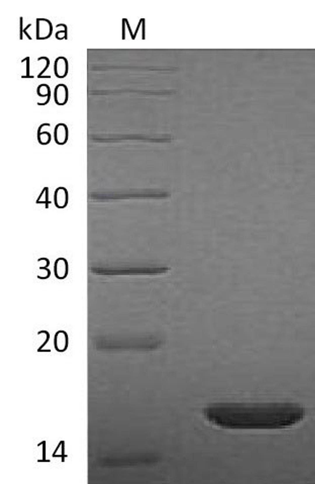 (Tris-Glycine gel) Discontinuous SDS-PAGE (reduced) with 5% enrichment gel and 15% separation gel.