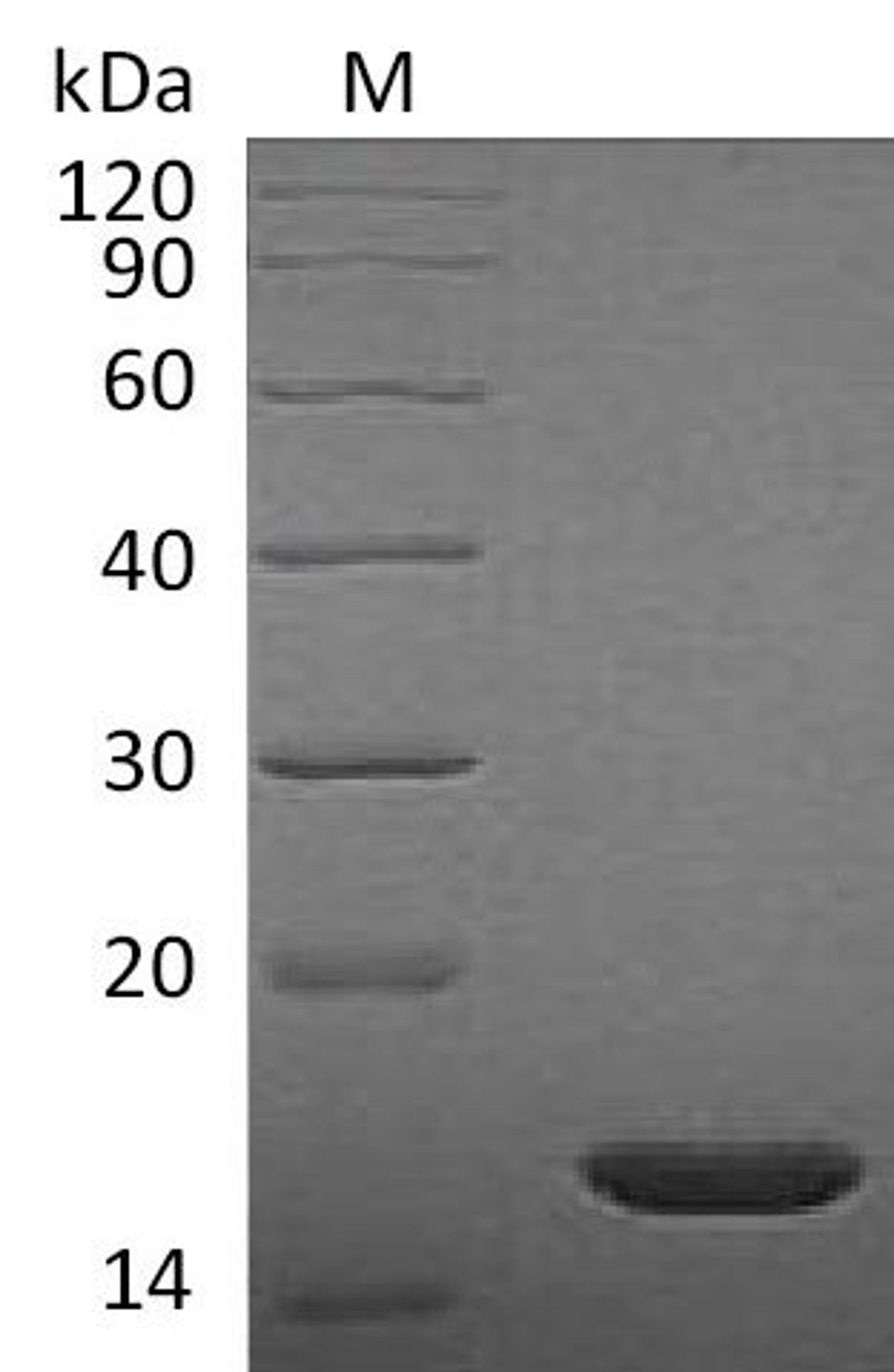 (Tris-Glycine gel) Discontinuous SDS-PAGE (reduced) with 5% enrichment gel and 15% separation gel.