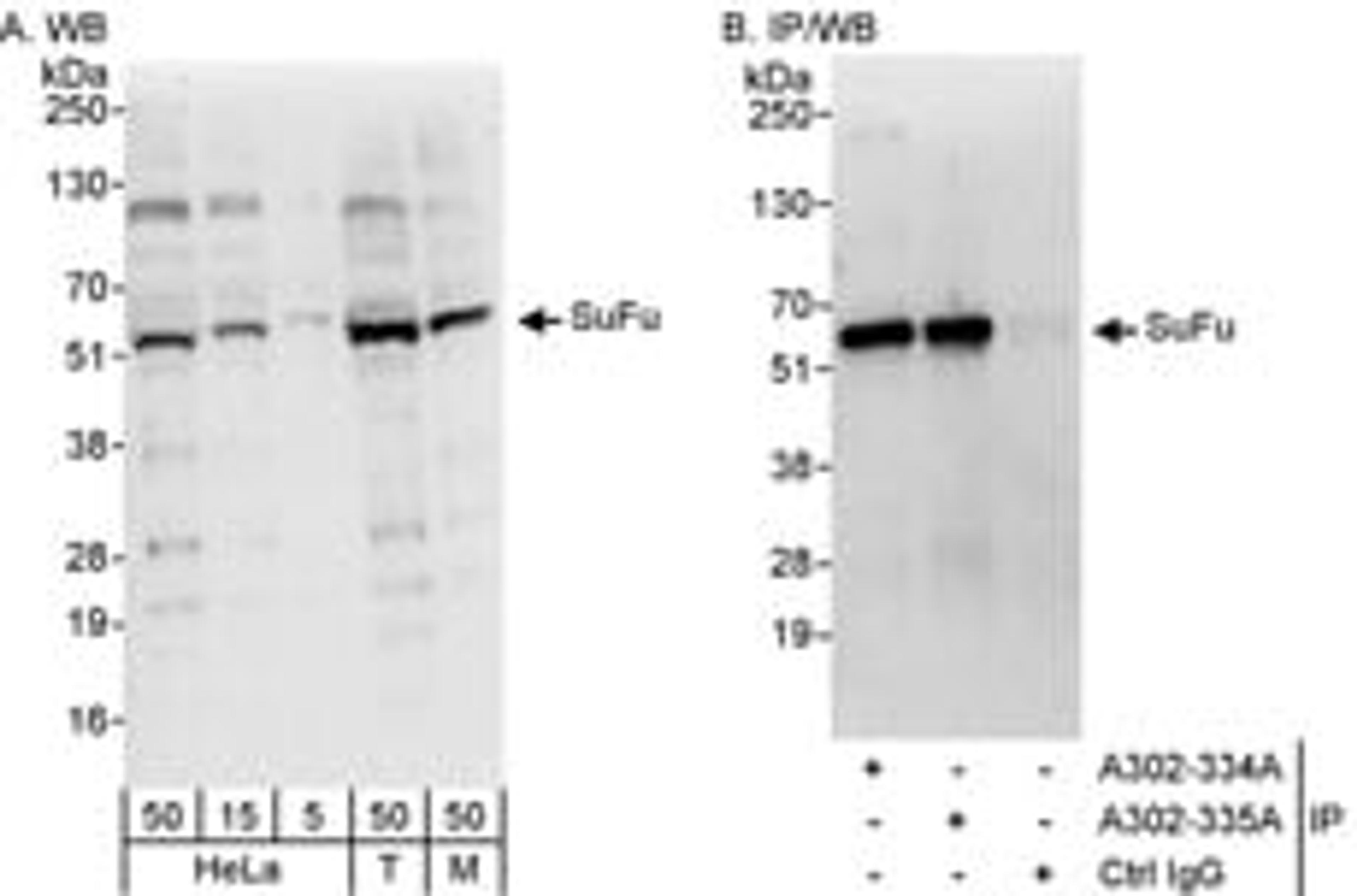 Detection of human and mouse SuFu by western blot (h&m) and immunoprecipitation (h).