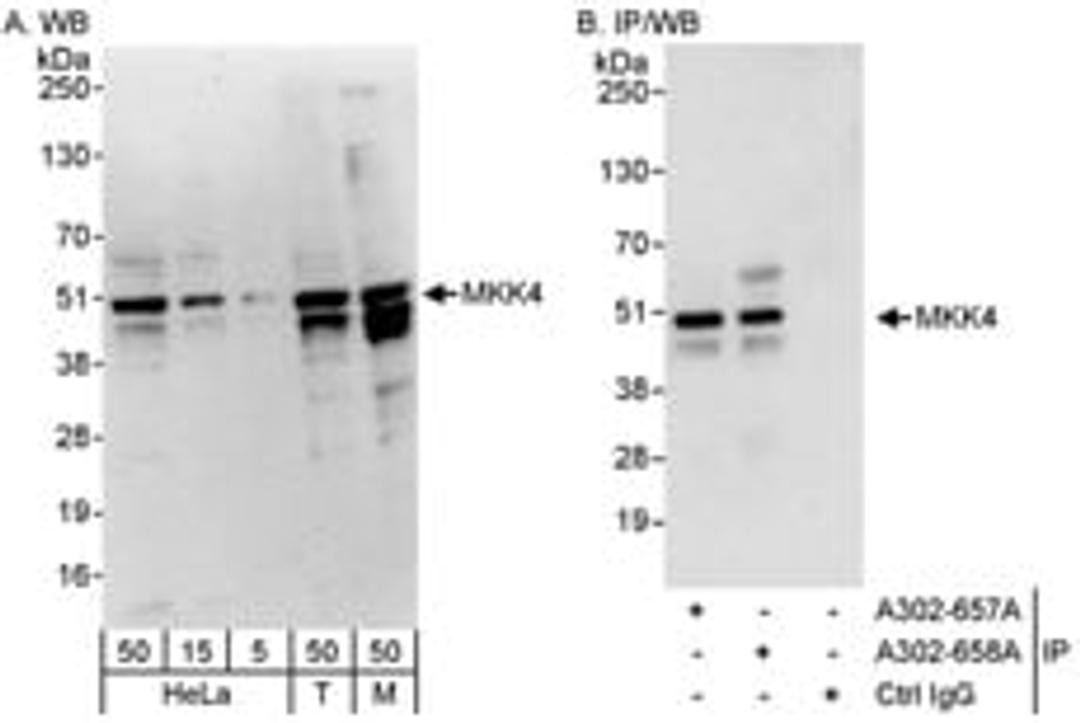 Detection of human and mouse MKK4 by western blot (h&m) and immunoprecipitation (h).