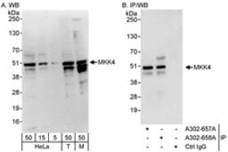 Detection of human and mouse MKK4 by western blot (h&m) and immunoprecipitation (h).