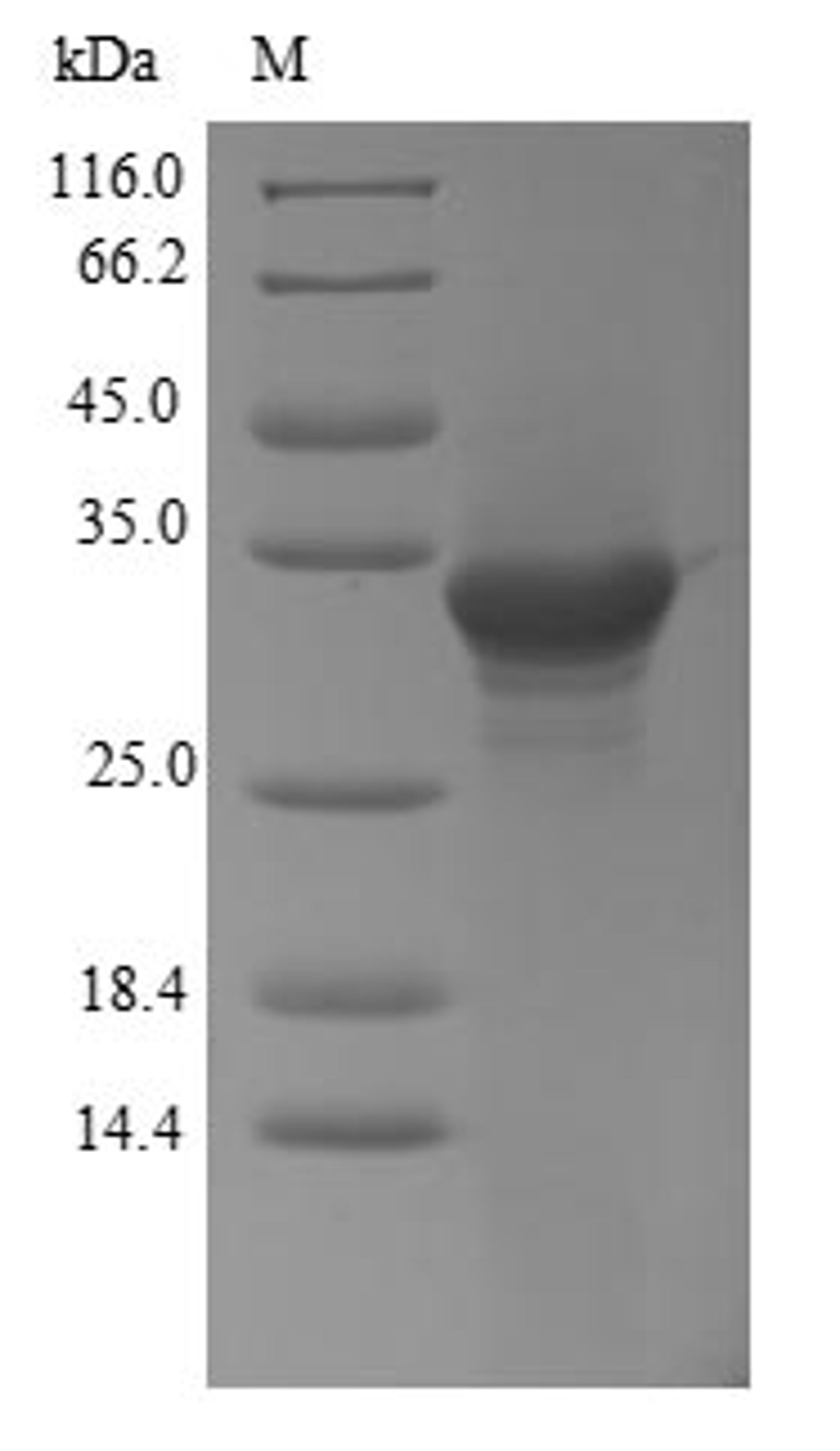 (Tris-Glycine gel) Discontinuous SDS-PAGE (reduced) with 5% enrichment gel and 15% separation gel.