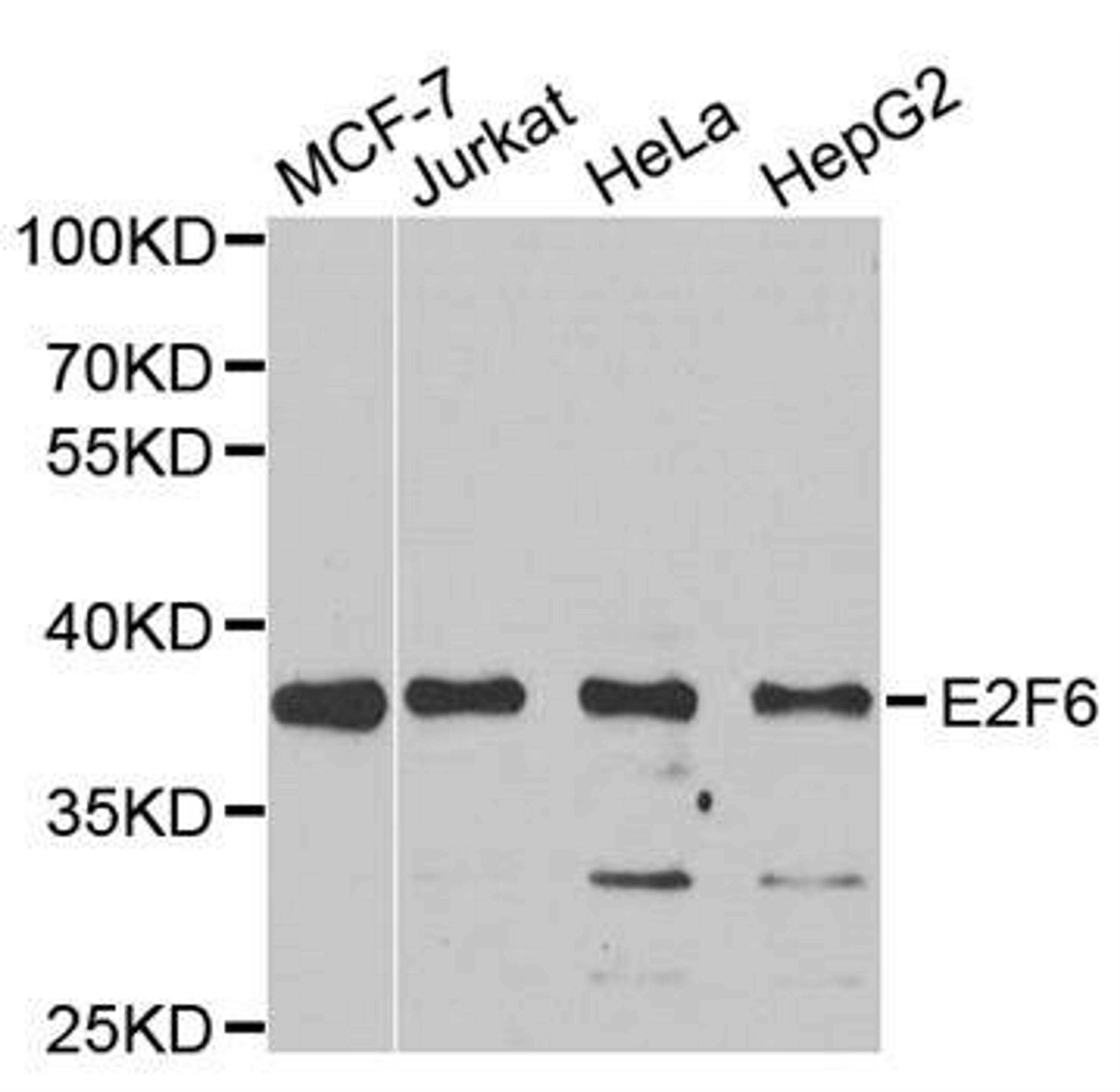 Western blot analysis of extracts of various cell lines using E2F6 antibody