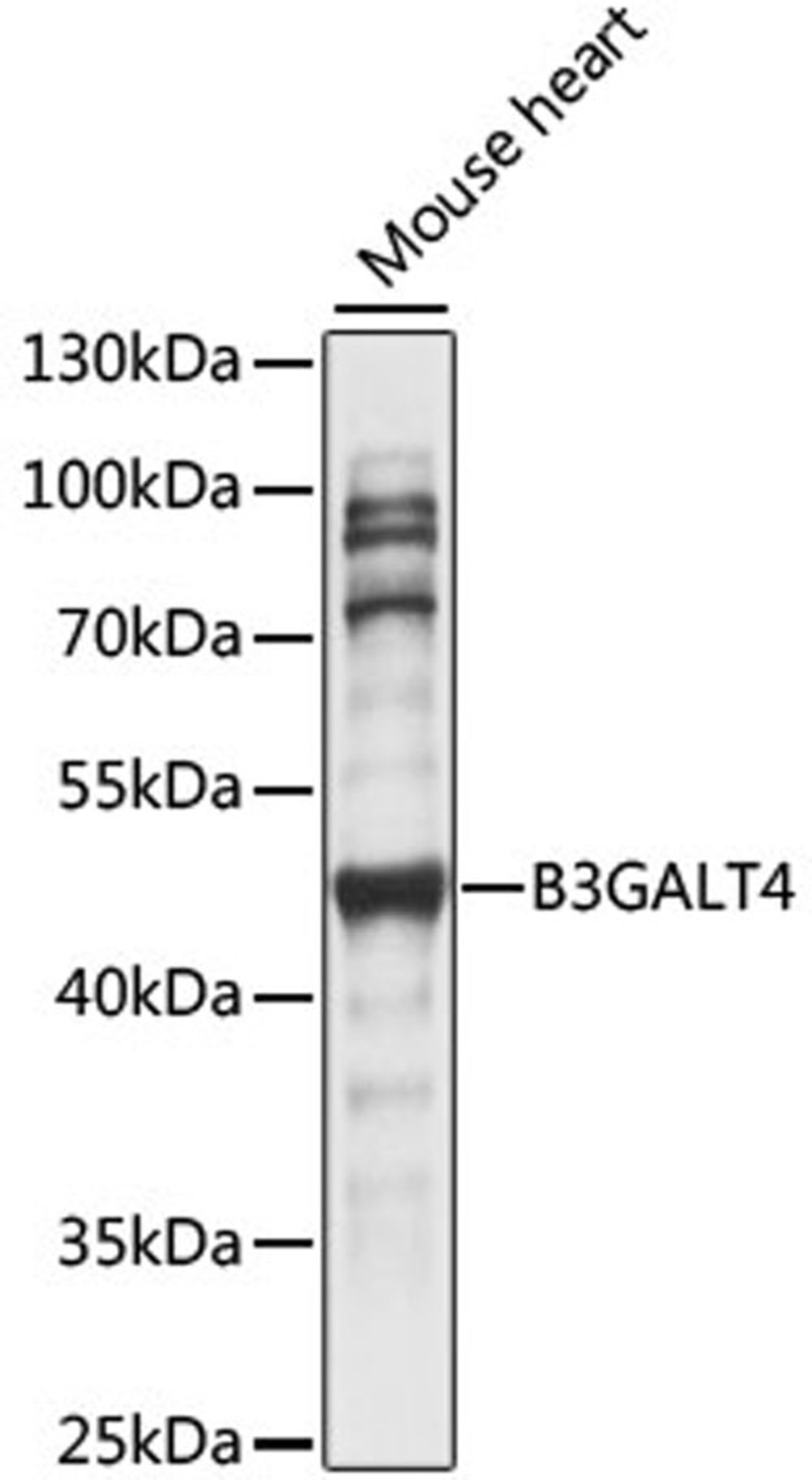 Western blot - B3GALT4 antibody (A15341)