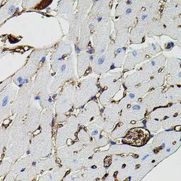 Immunohistochemistry - MMP9 antibody (A11521)
