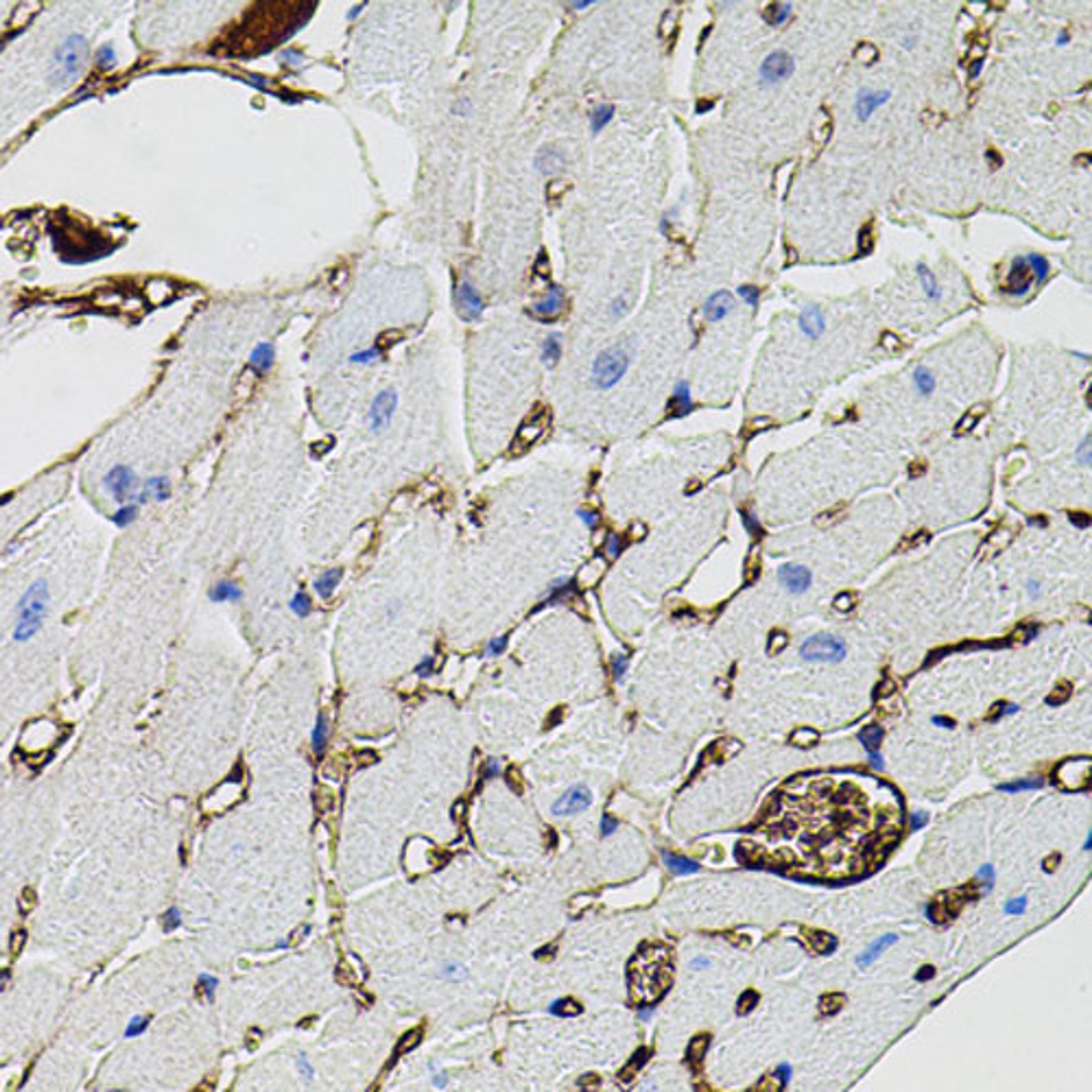 Immunohistochemistry - MMP9 antibody (A11521)