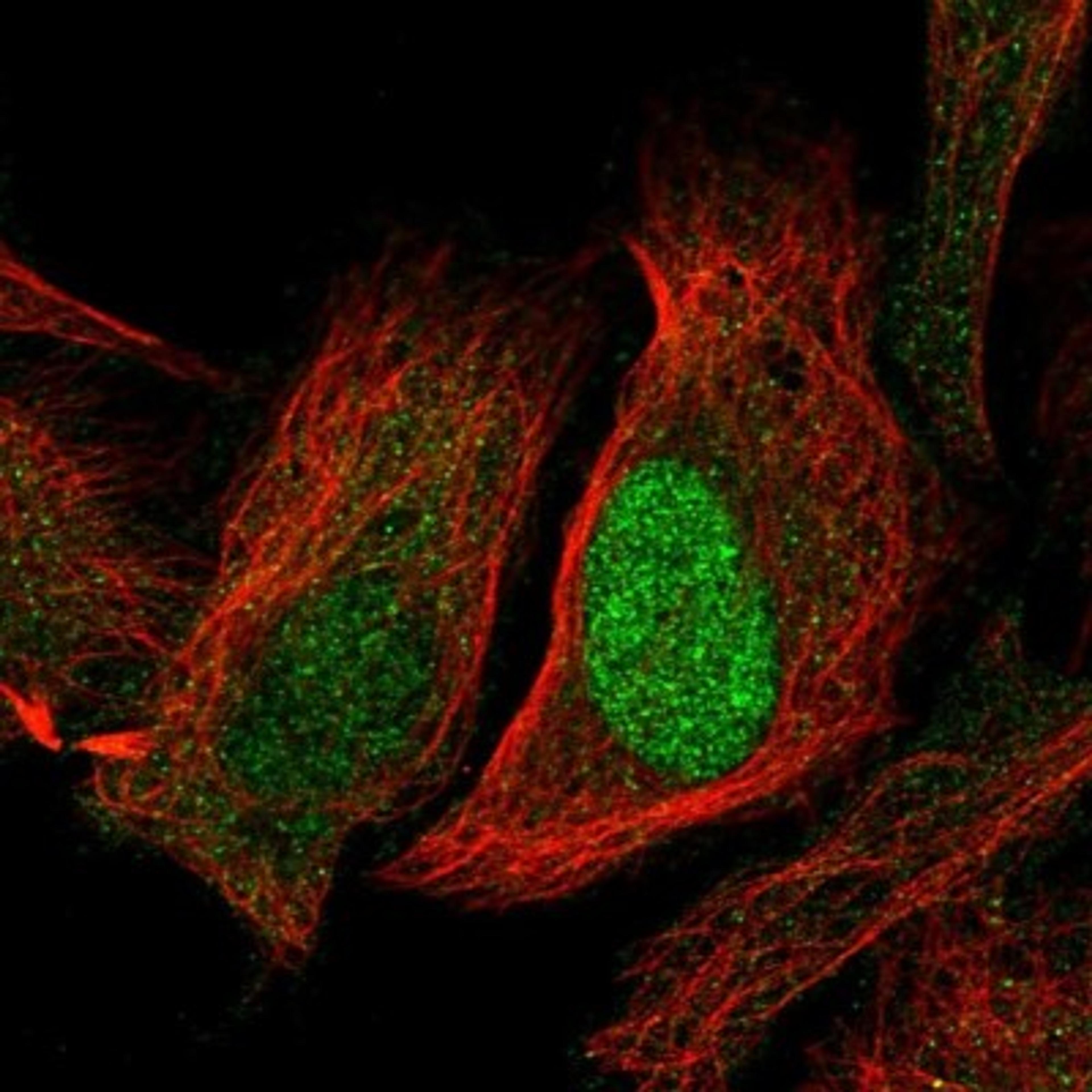 Immunocytochemistry/Immunofluorescence: FARSB Antibody [NBP1-83923] - Staining of human cell line U-2 OS shows positivity in nucleus & cytoplasm.