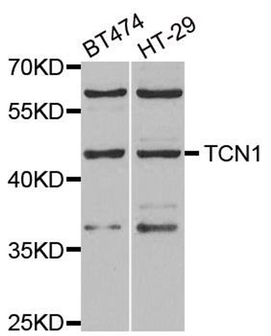 Western blot analysis of extracts of various cell lines using TCN1 antibody