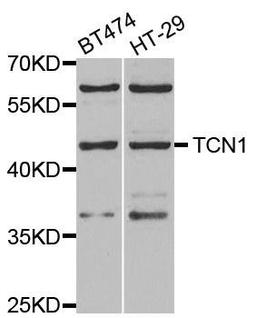 Western blot analysis of extracts of various cell lines using TCN1 antibody