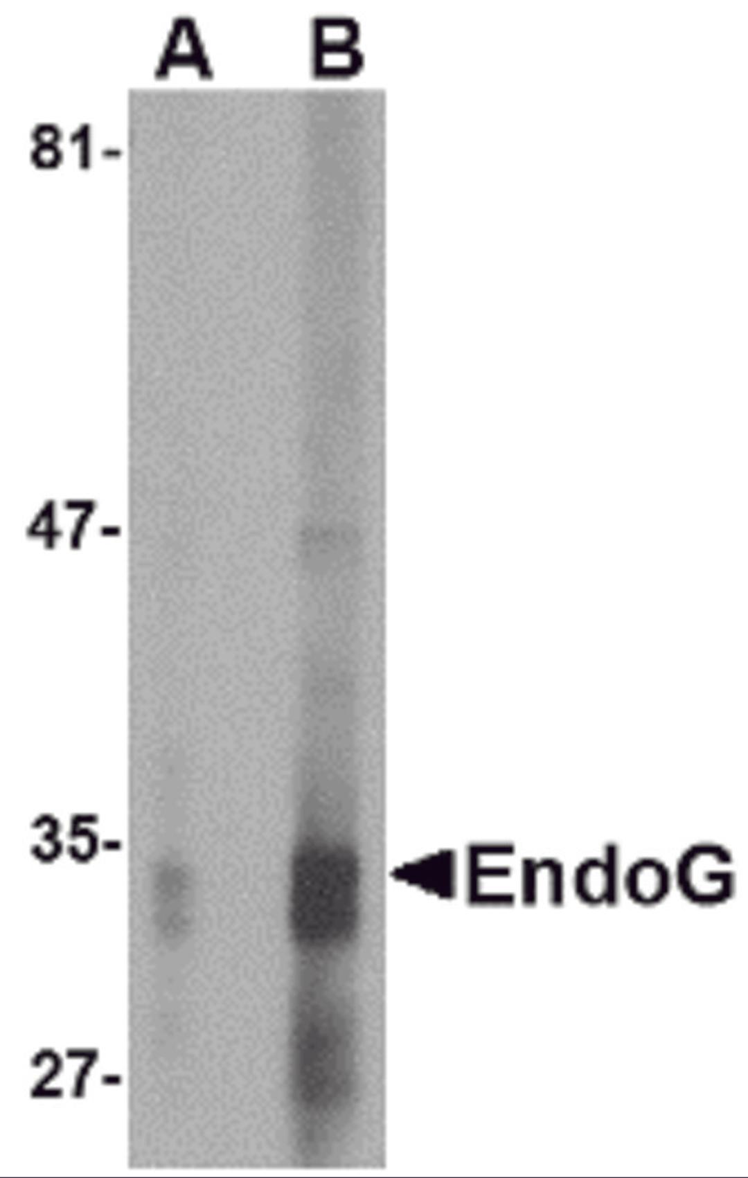 Western blot analysis of EndoG expression in HepG2 cell lysate with EndoG antibody at (A) 2.5 and (B) 5 &#956;g/mL.