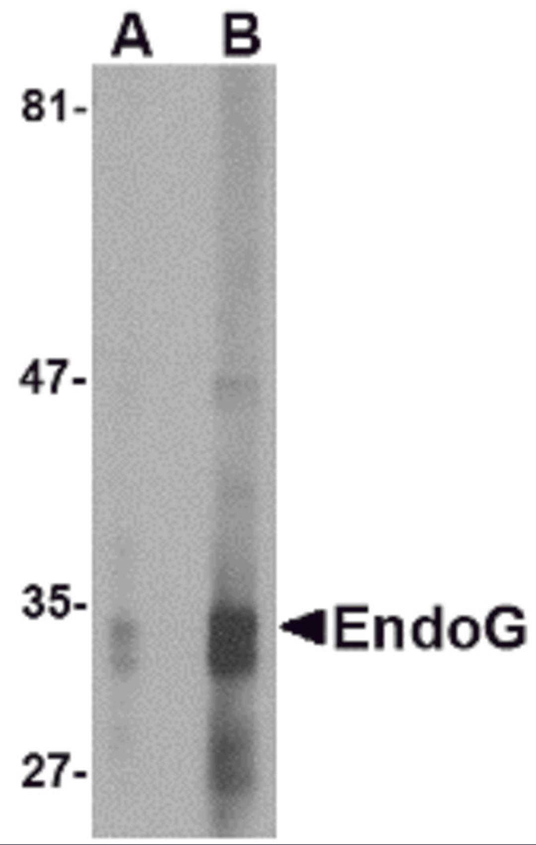 Western blot analysis of EndoG expression in HepG2 cell lysate with EndoG antibody at (A) 2.5 and (B) 5 μg/mL.