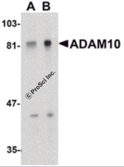 Western blot analysis of ADAM10 in Jurkat whole cell lysate with ADAM10 antibody at (A) 1 and (B) 2 &#956;g/mL.