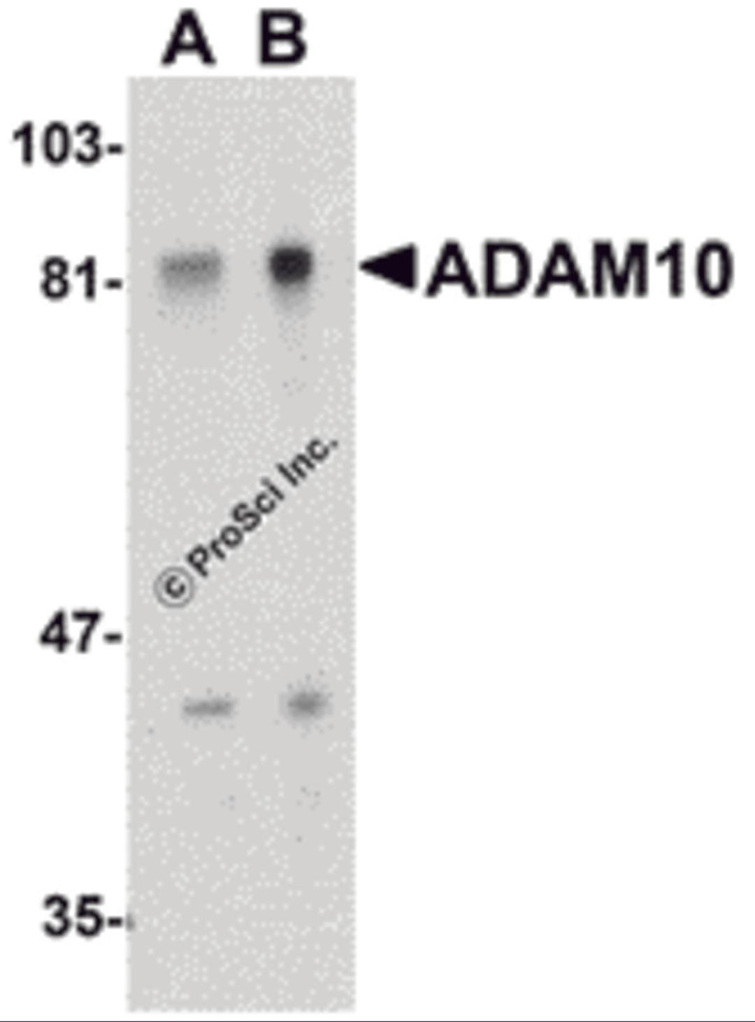 Western blot analysis of ADAM10 in Jurkat whole cell lysate with ADAM10 antibody at (A) 1 and (B) 2 μg/mL.