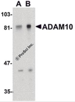 Western blot analysis of ADAM10 in Jurkat whole cell lysate with ADAM10 antibody at (A) 1 and (B) 2 μg/mL.
