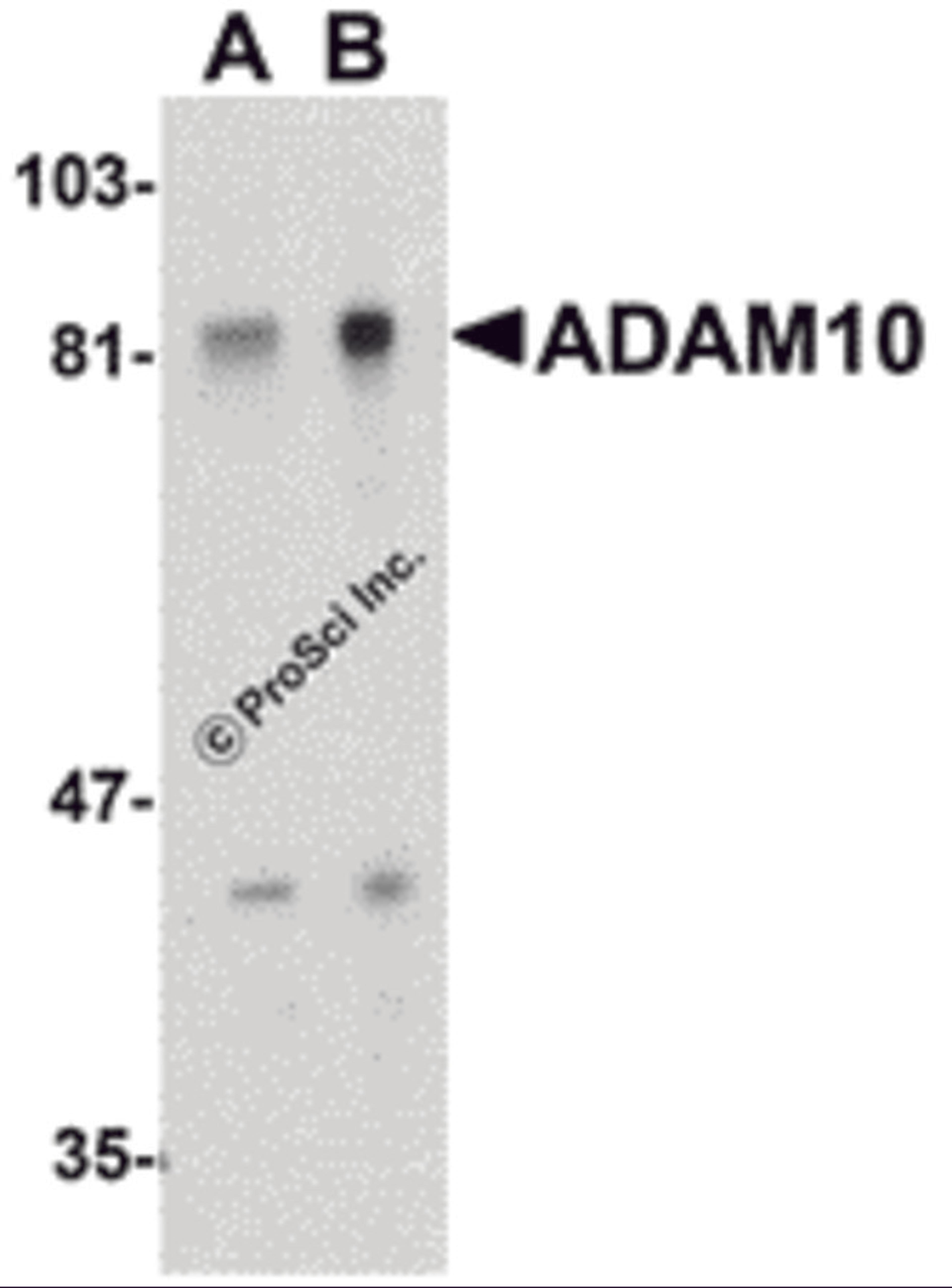 Western blot analysis of ADAM10 in Jurkat whole cell lysate with ADAM10 antibody at (A) 1 and (B) 2 μg/mL.