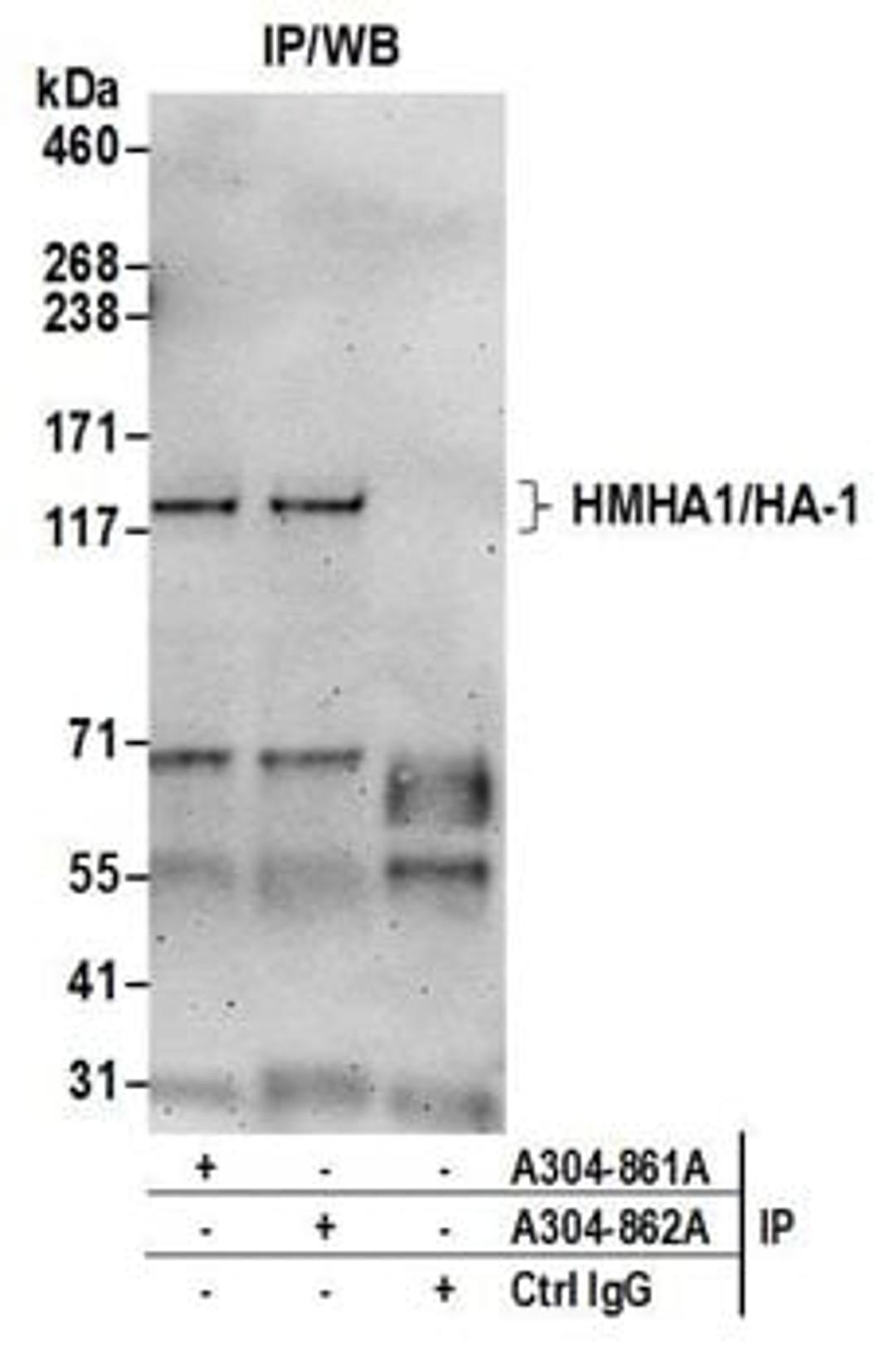 Detection of human HMHA1/HA-1 by western blot of immunoprecipitates.