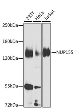 Western blot - NUP155 Antibody (A7764)