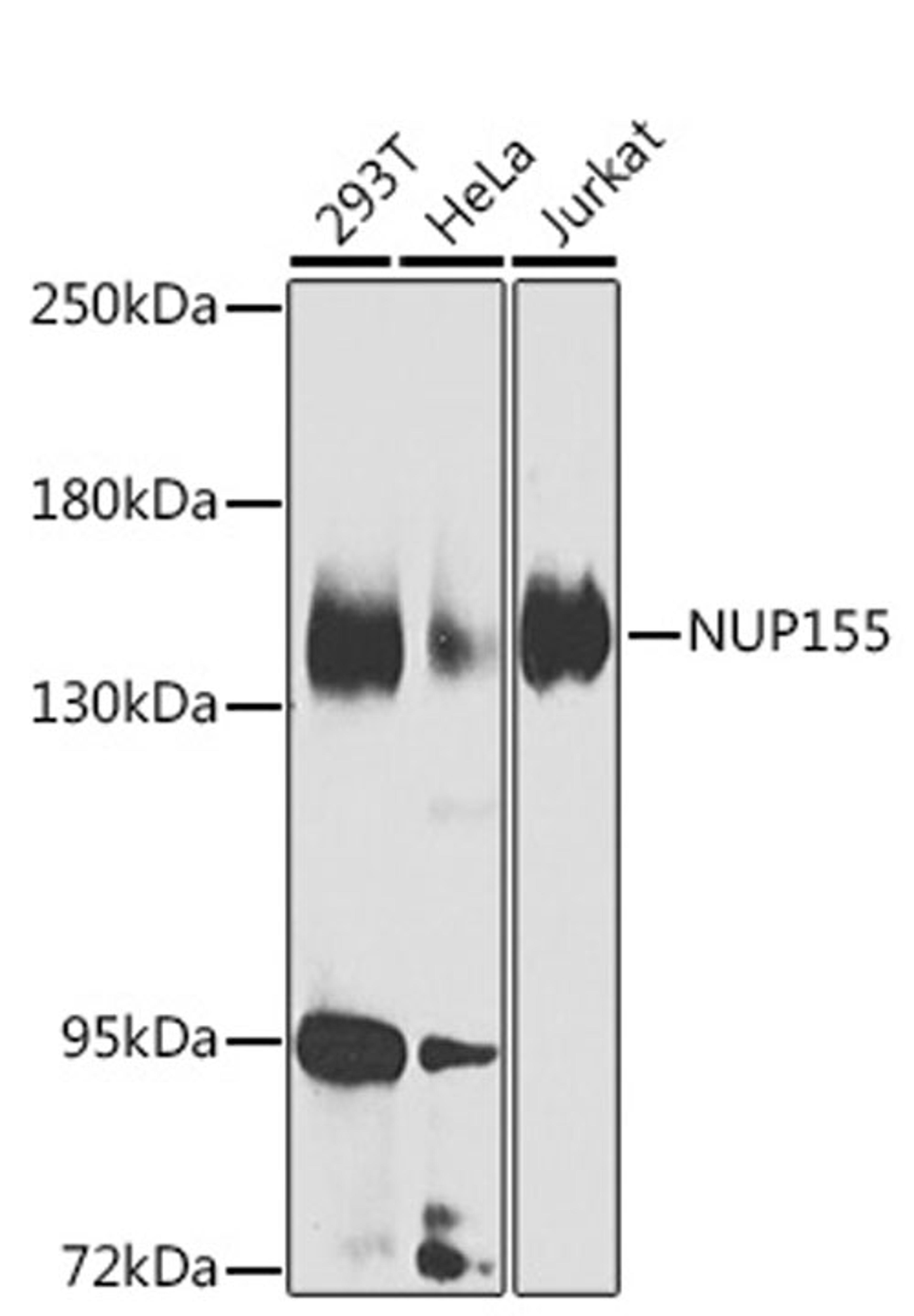 Western blot - NUP155 Antibody (A7764)