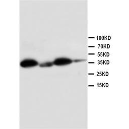 Western blot analysis of Lane 1: HELA Cell Lysate, Lane 2: SMMC Cell Lysate, Lane 3: RAJI Cell Lysate, Lane 4: COLO320 Cell Lysate using HSD11B1 antibody.