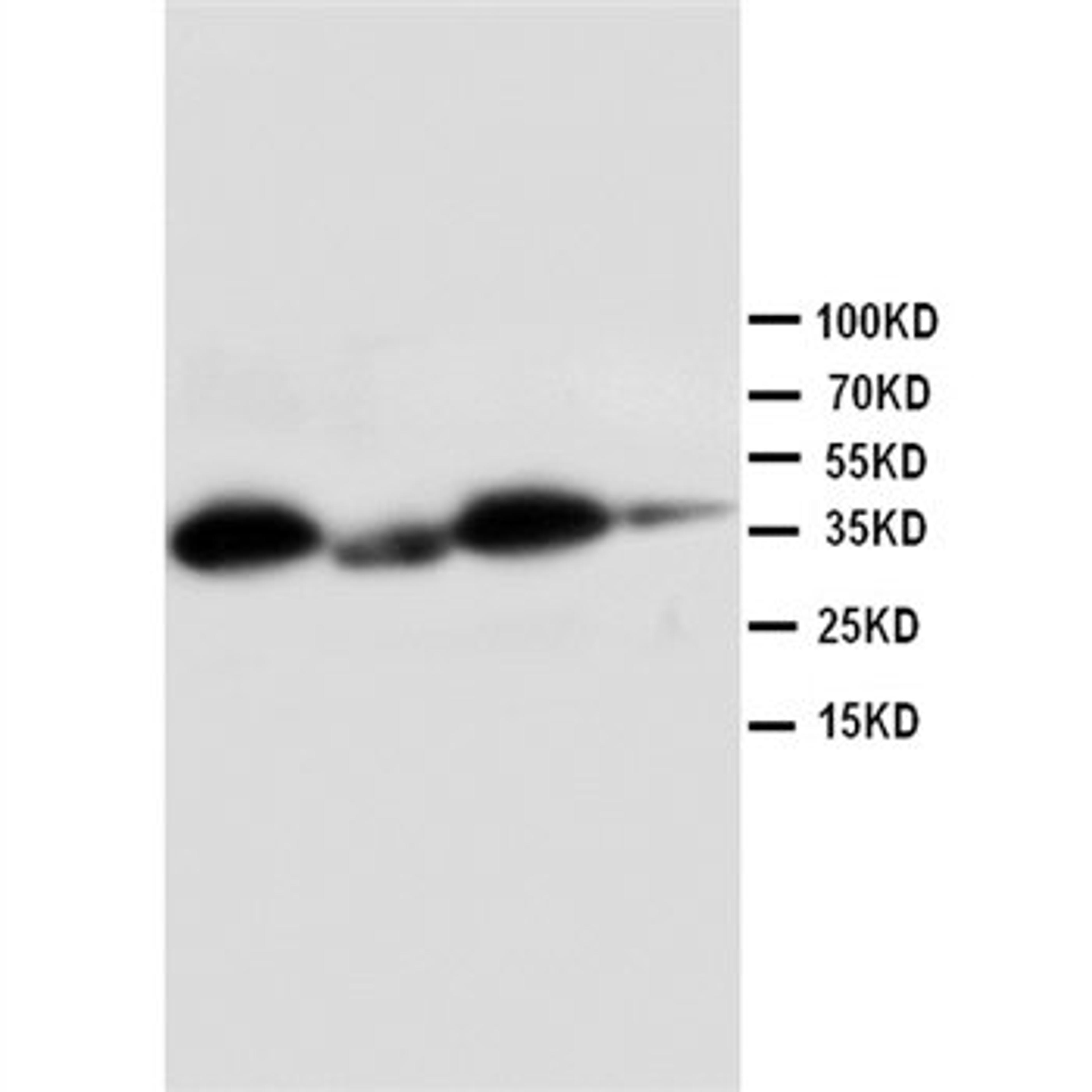 Western blot analysis of Lane 1: HELA Cell Lysate, Lane 2: SMMC Cell Lysate, Lane 3: RAJI Cell Lysate, Lane 4: COLO320 Cell Lysate using HSD11B1 antibody.