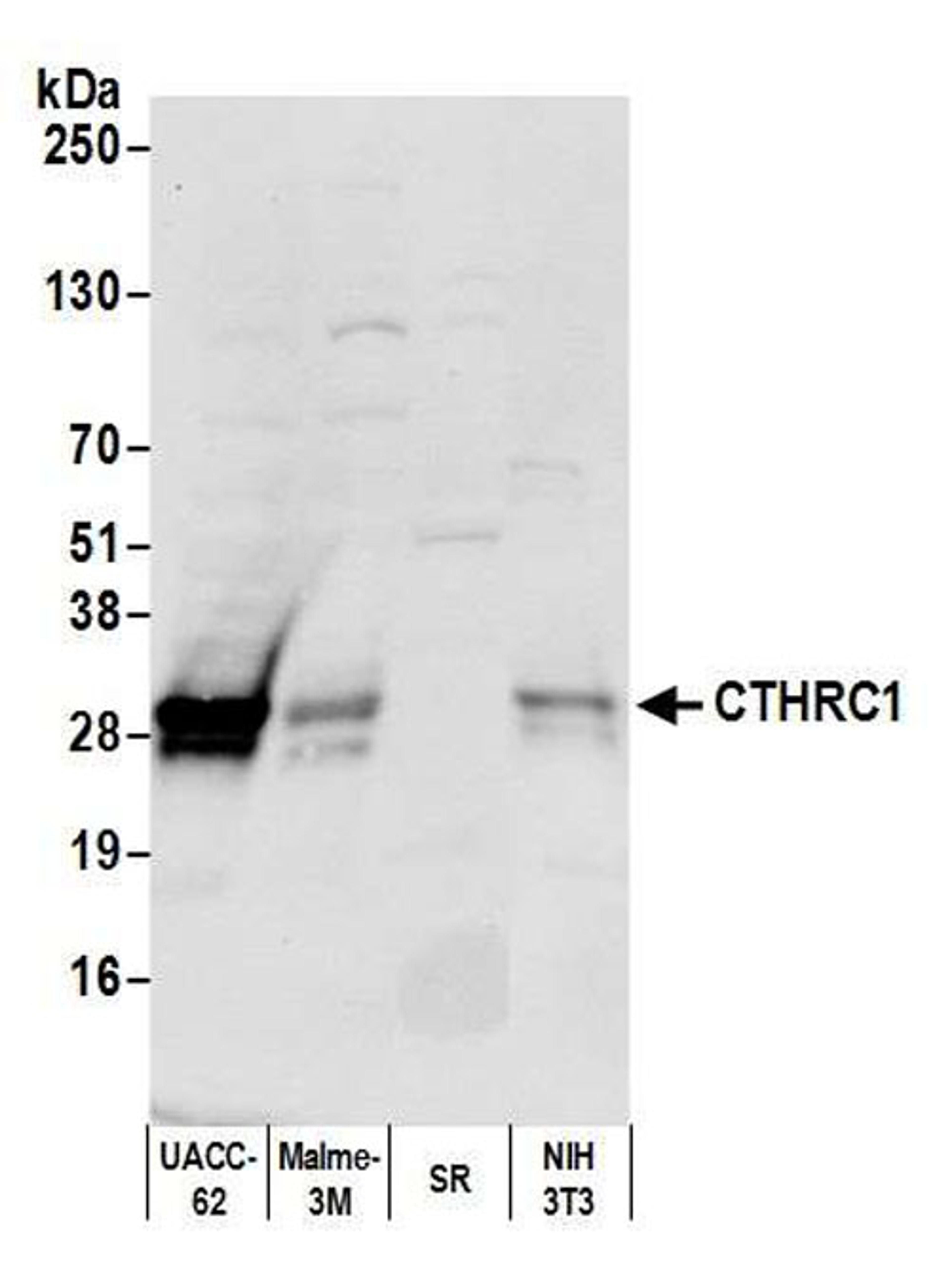 Detection of human and mouse CTHRC1 by WB.