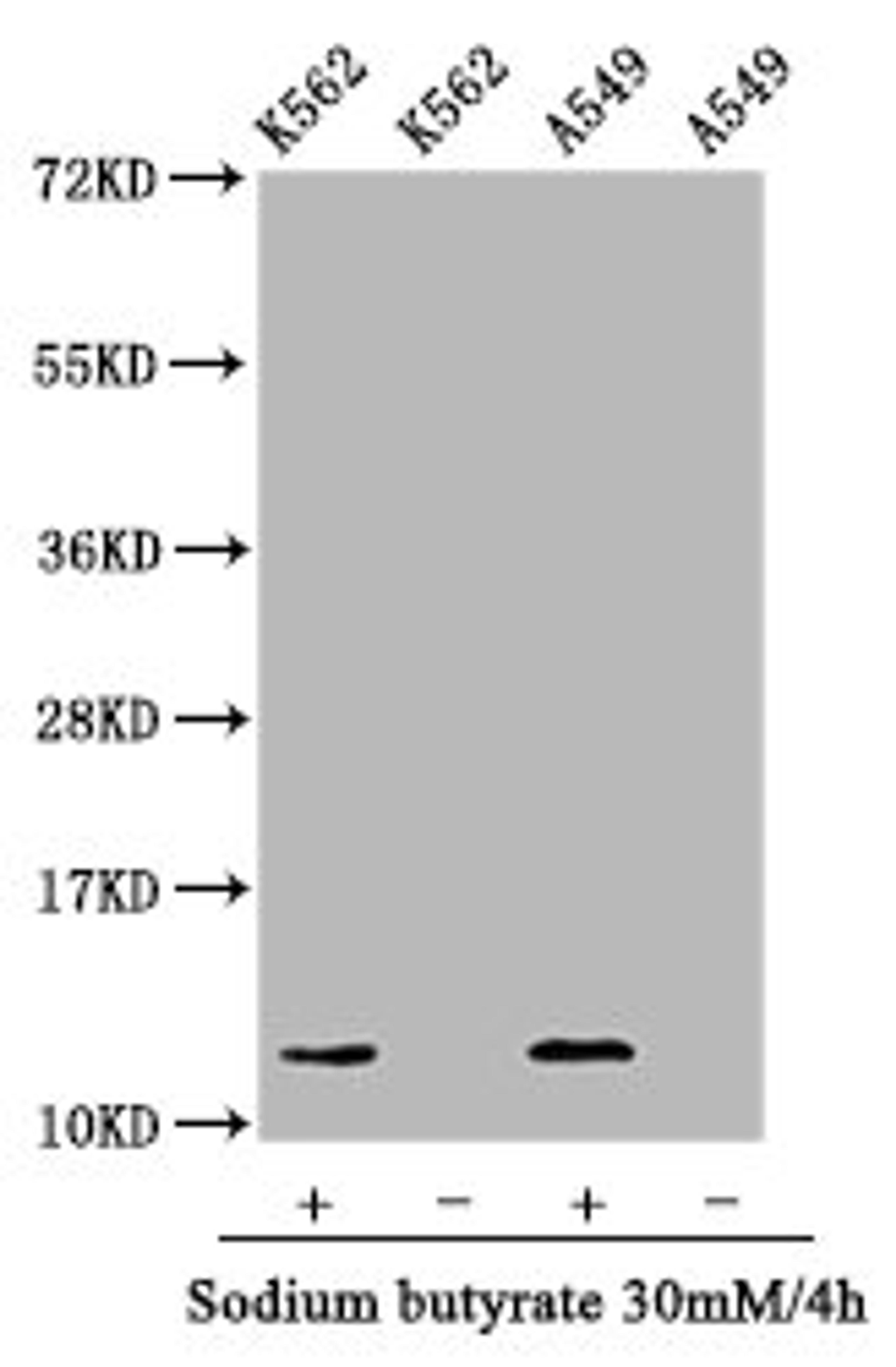 Western Blot. Positive WB detected in: K562 whole cell lysate, A549 whole cell lysate (treated with 30mM sodium butyrate for 4h or not). All lanes: HIST1H4A antibody at 1.05µg/ml. Secondary. Goat polyclonal to rabbit IgG at 1/50000 dilution. Predicted band size: 12 kDa. Observed band size: 12 kDa