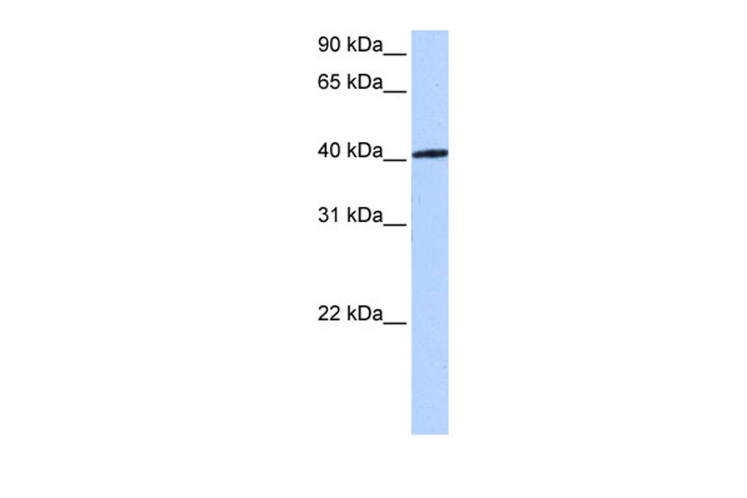 Antibody used in WB on Human 721_B at 0.2-1 ug/ml.