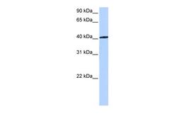 Antibody used in WB on Human 721_B at 0.2-1 ug/ml.