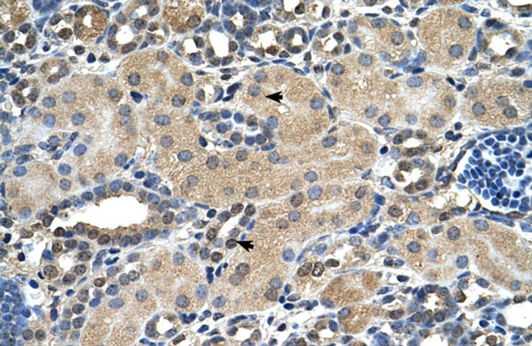 Antibody used in IHC on Human kidney.