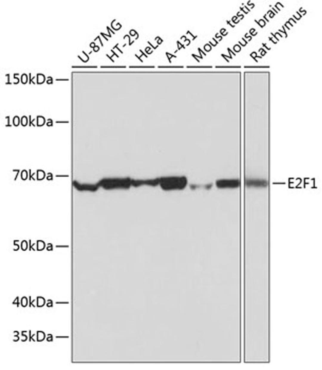 Western blot - E2F1 antibody (A19579)