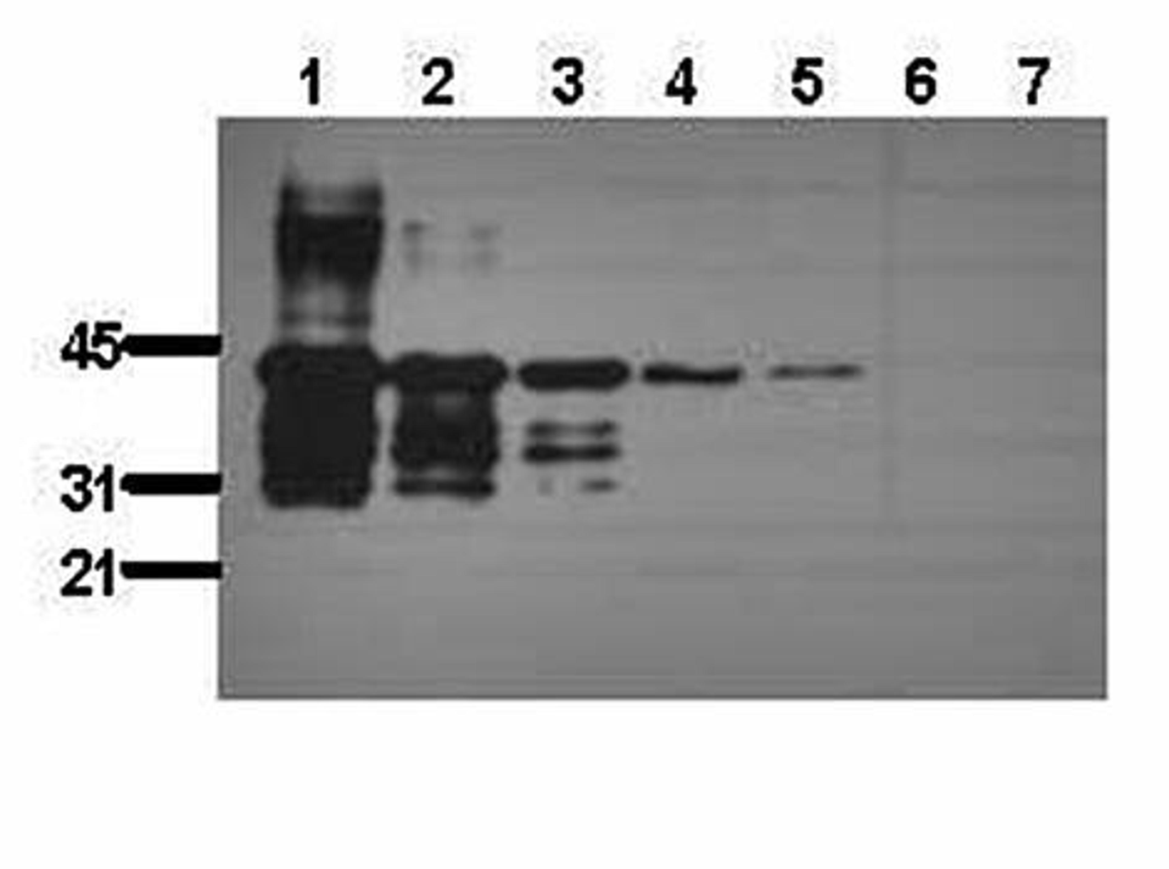 Western blot analysis of 50ng (Lane1),25ng(Lane2),10ng(Lane3),2ng(Lane4),1ng(Lane5) using GST (pGEX) antibody