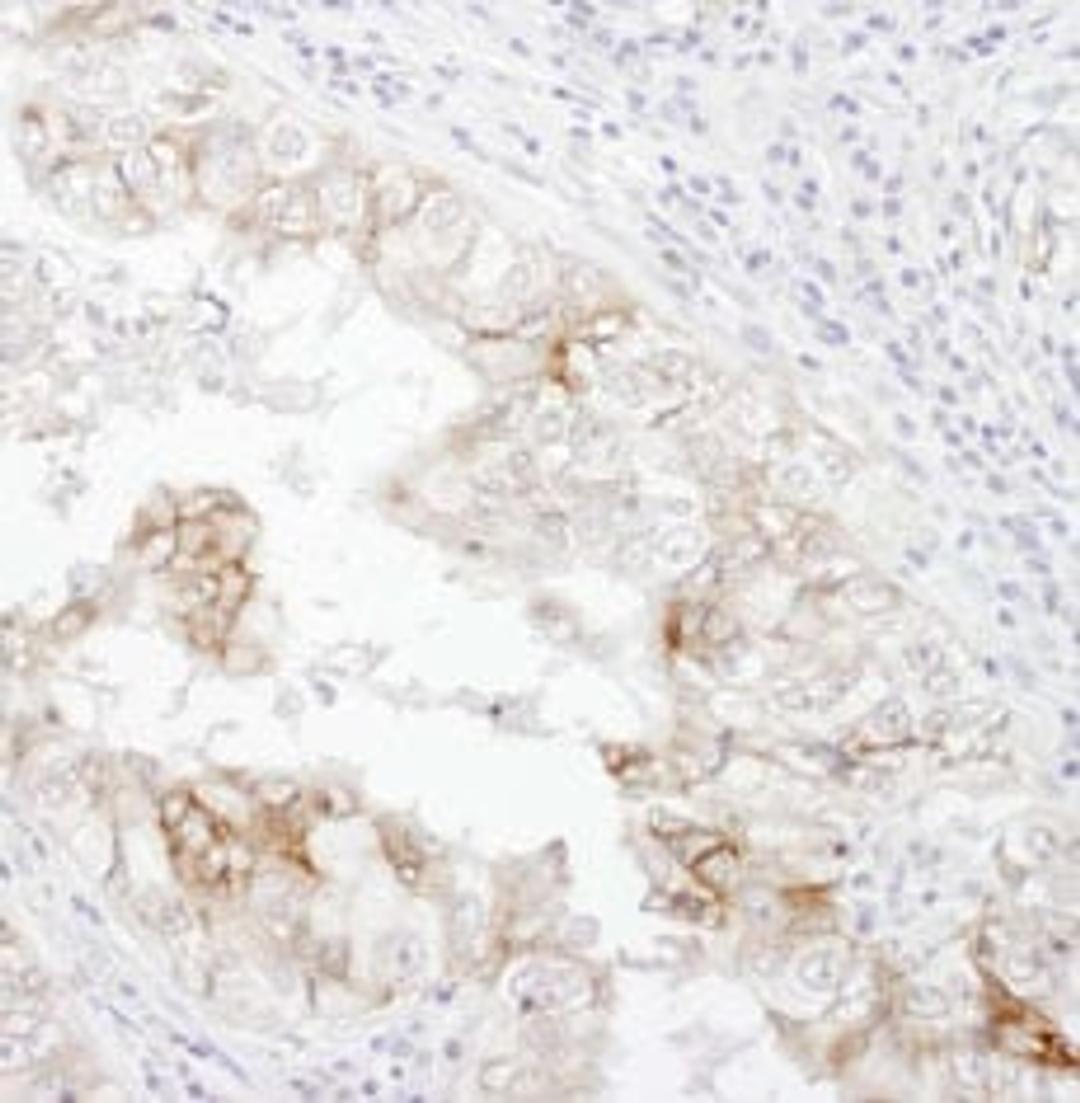 Detection of human CD98 by immunohistochemistry.