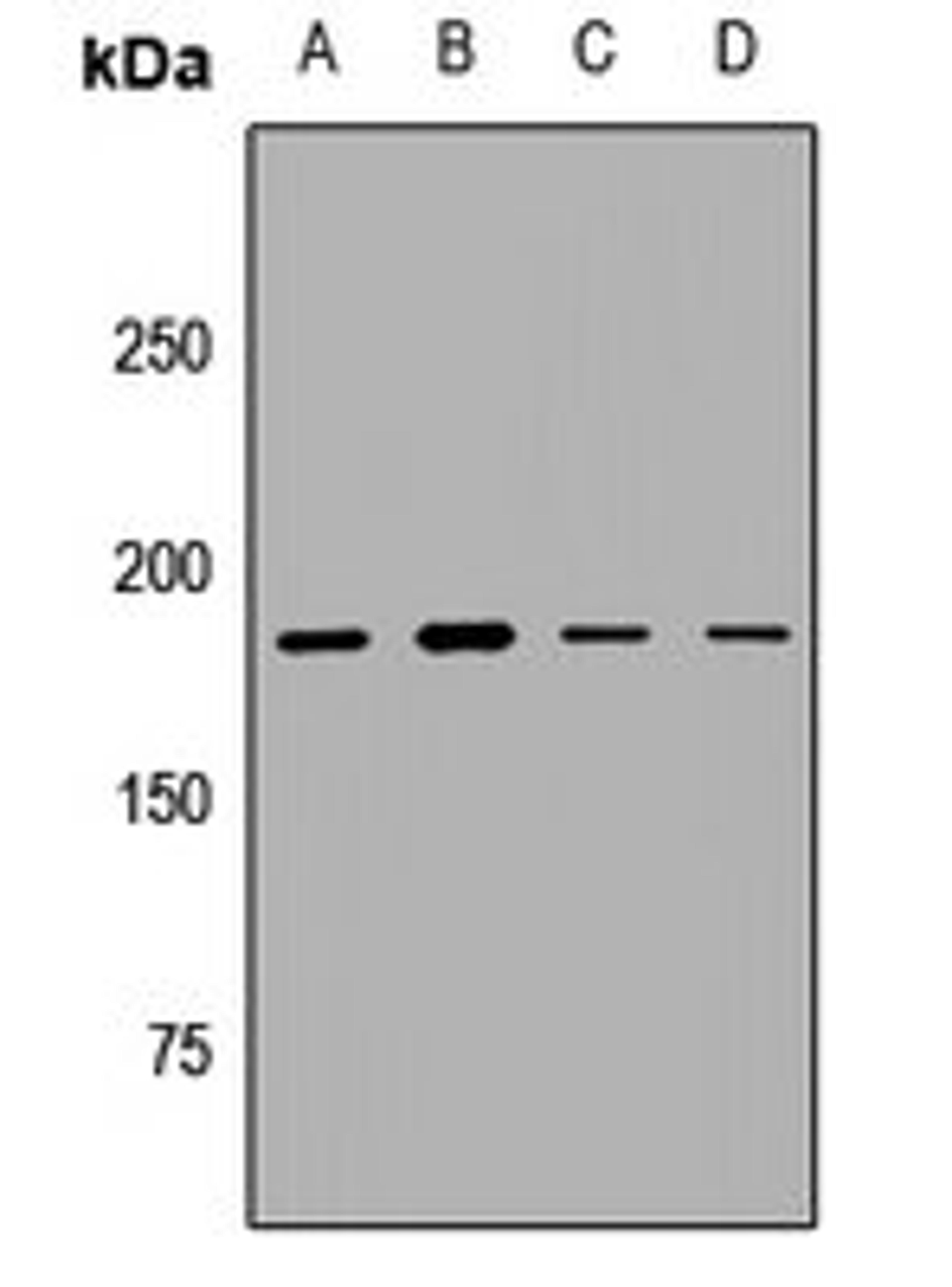 Western blot analysis of SHSY5Y (Lane1), Hela (Lane2), Jurkat (Lane3), mouse lung (Lane4) whole cell lysates using KMT2A antibody