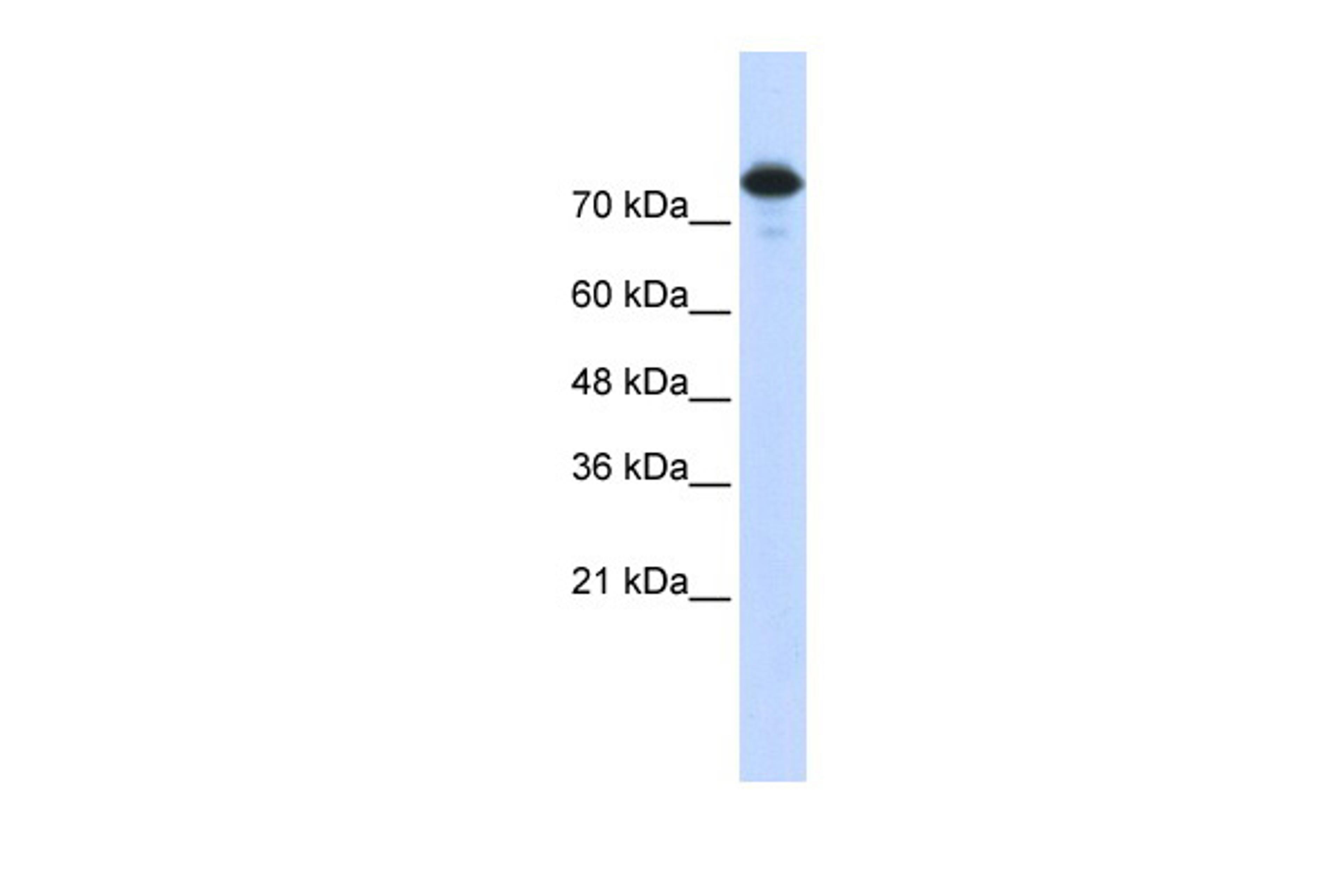 Antibody used in WB on Transfected 293T at 0.2-1 ug/ml.