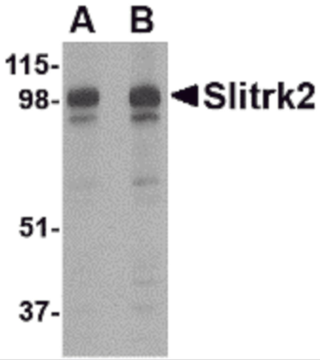 Western blot analysis of Slitrk2 in rat brain tissue lysate with Slitrk2 antibody at (A) 1 and (B) 2 &#956;g/mL.