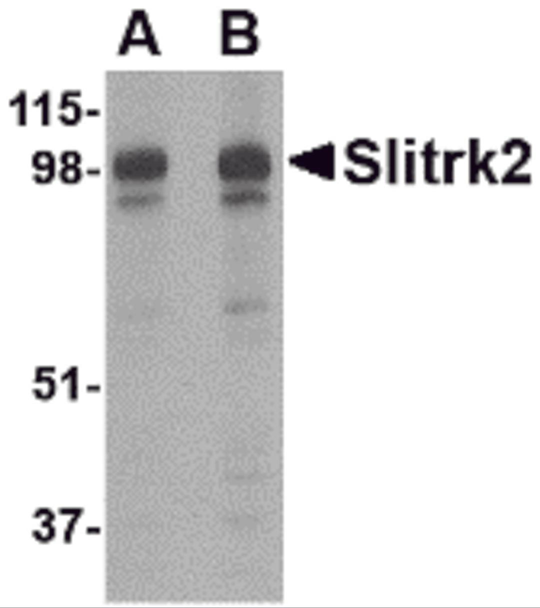 Western blot analysis of Slitrk2 in rat brain tissue lysate with Slitrk2 antibody at (A) 1 and (B) 2 μg/mL.