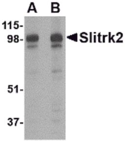 Western blot analysis of Slitrk2 in rat brain tissue lysate with Slitrk2 antibody at (A) 1 and (B) 2 μg/mL.