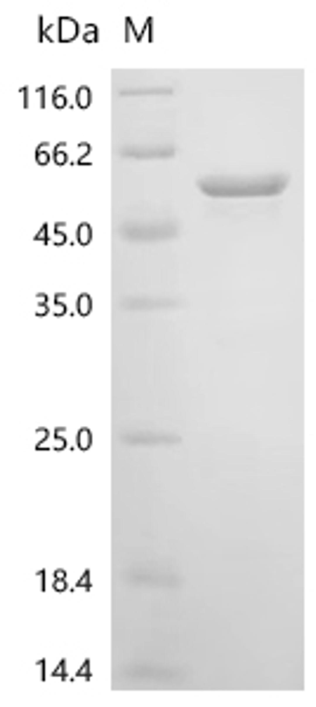 (Tris-Glycine gel) Discontinuous SDS-PAGE (reduced) with 5% enrichment gel and 15% separation gel.