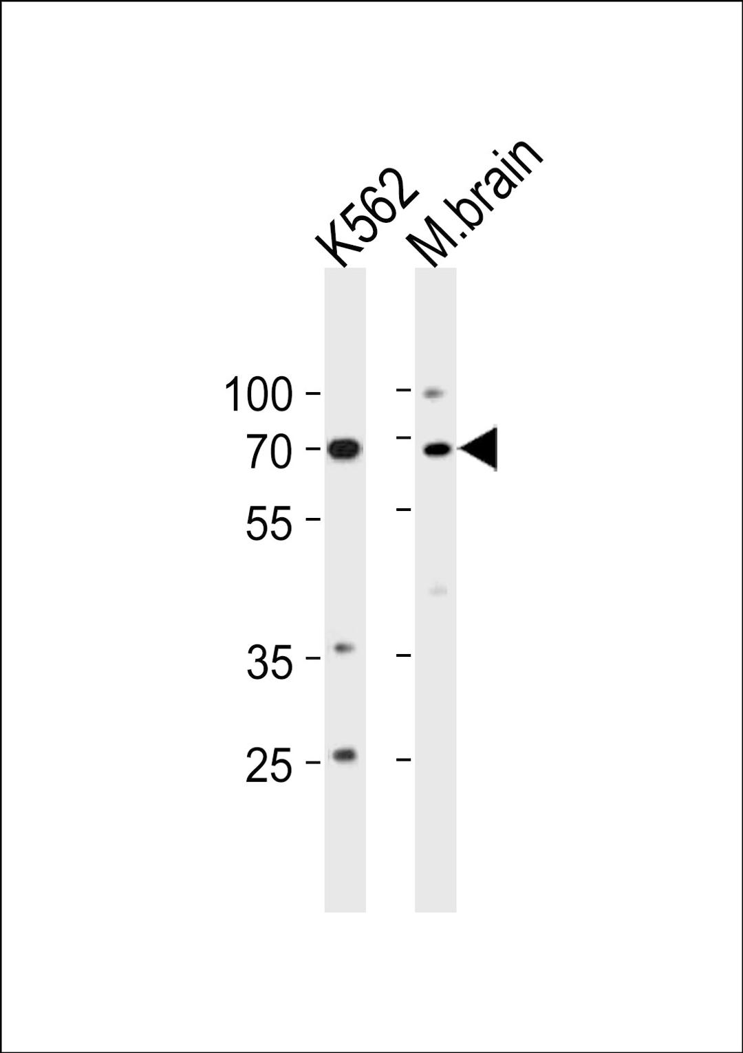 Western blot analysis in K562 cell line and mouse brain tissue lysates (35ug/lane).