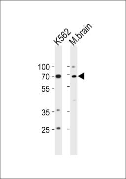 Western blot analysis in K562 cell line and mouse brain tissue lysates (35ug/lane).