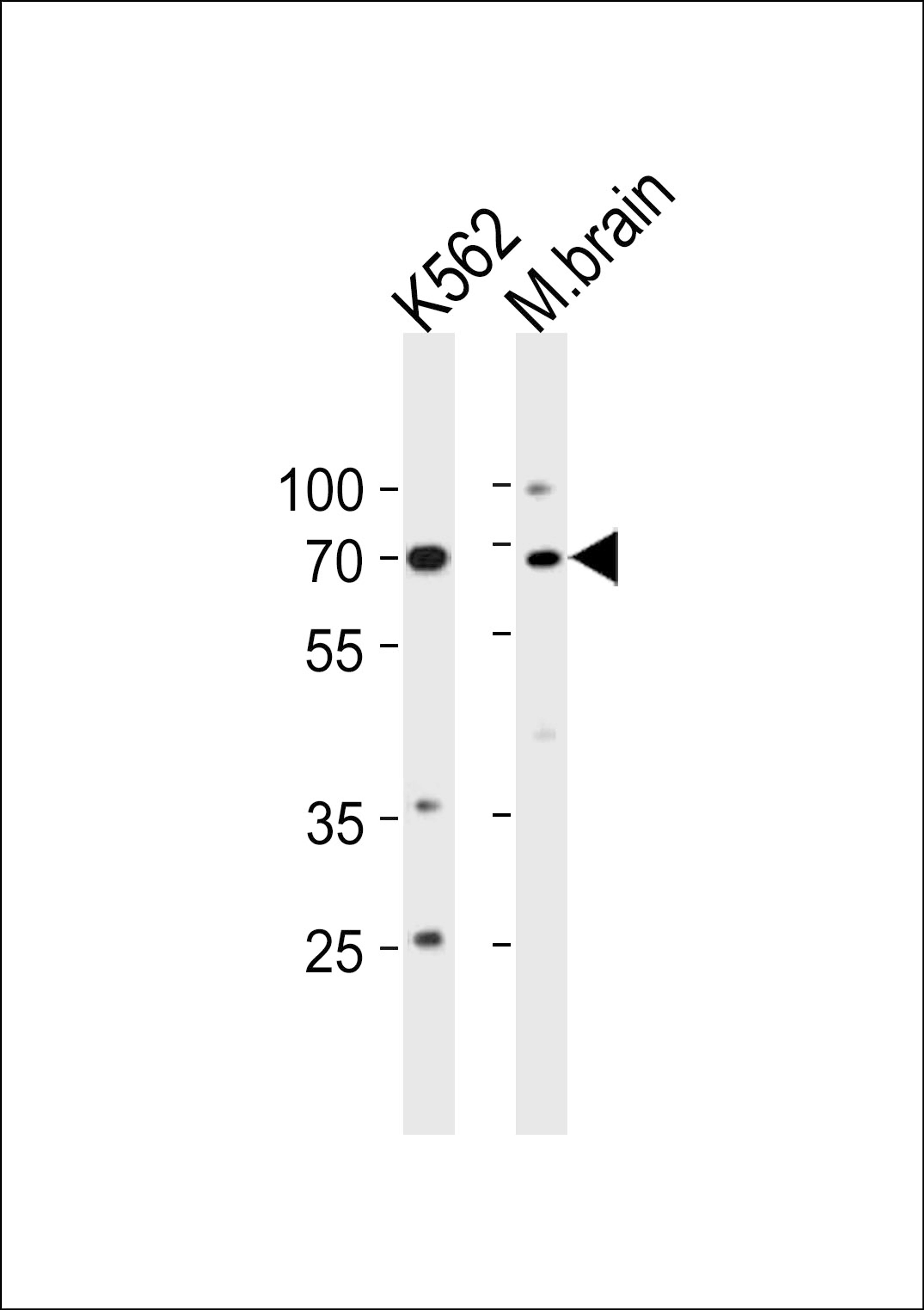 Western blot analysis in K562 cell line and mouse brain tissue lysates (35ug/lane).