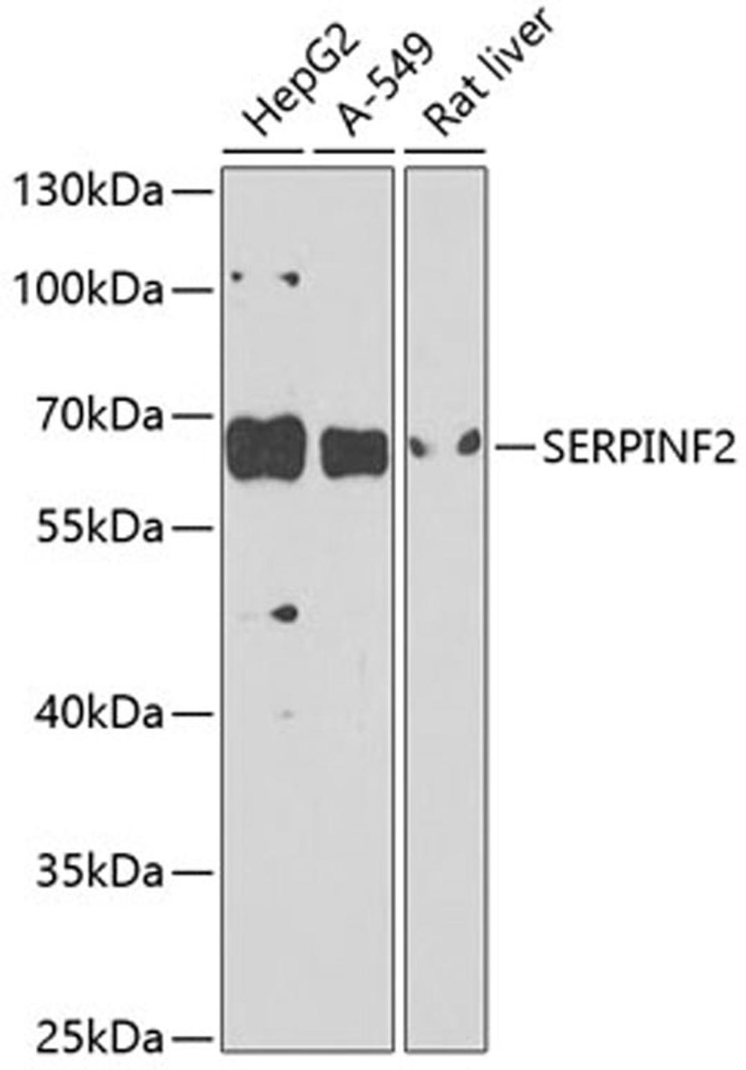 Western blot - SERPINF2 antibody (A9945)