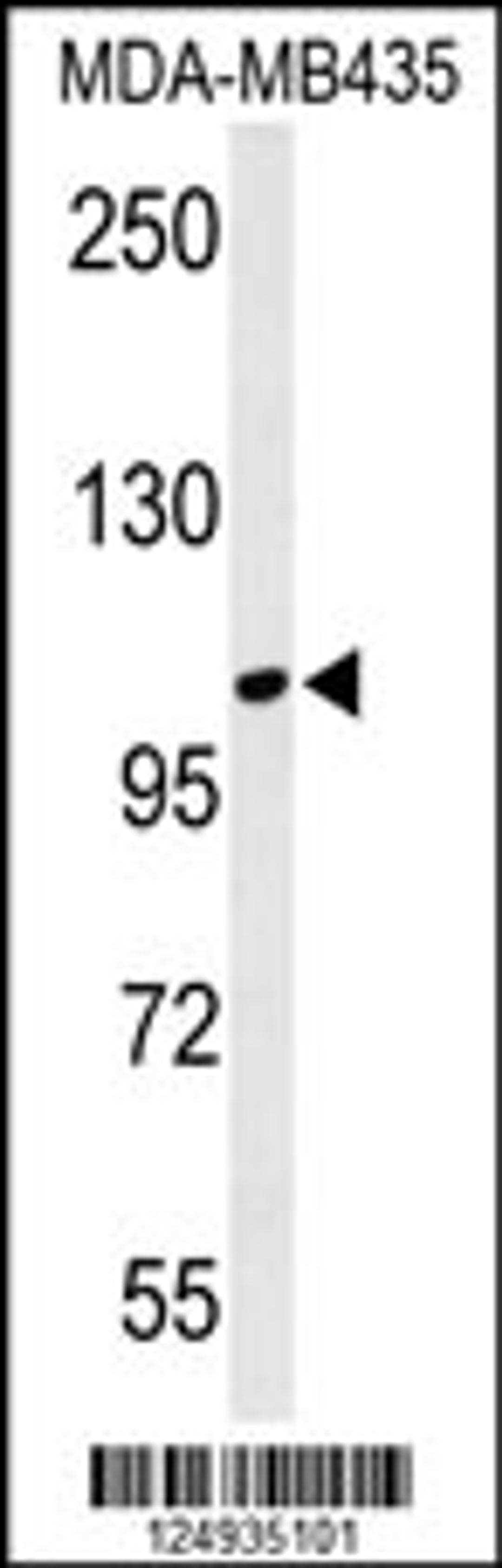 Western blot analysis of LUZP1 Antibody in MDA-MB435 cell line lysates (35ug/lane)