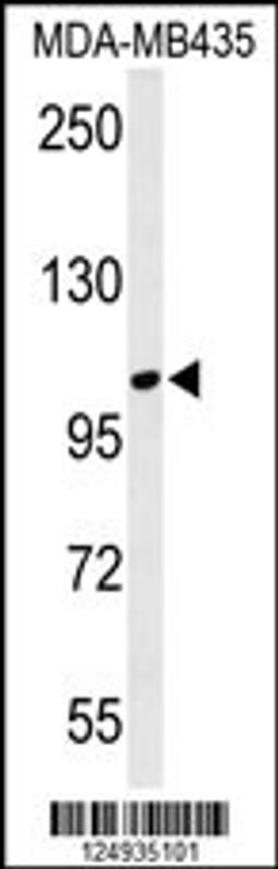 Western blot analysis of LUZP1 Antibody in MDA-MB435 cell line lysates (35ug/lane)