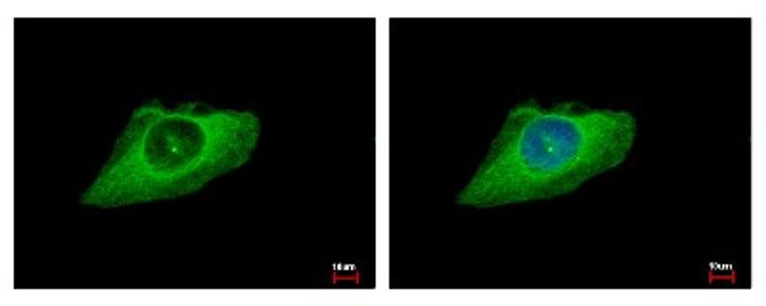 Immunocytochemistry/Immunofluorescence: Cytokeratin 8 Antibody [NBP2-16094] - HeLa cells were fixed in iced-cold MeOH for 5 min. Green: KRT8 protein stained by Cytokeratin 8 antibody diluted at 1:500. Blue: Hoechst 33343 staining.