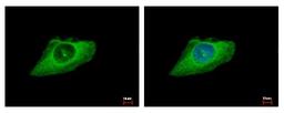 Immunocytochemistry/Immunofluorescence: Cytokeratin 8 Antibody [NBP2-16094] - HeLa cells were fixed in iced-cold MeOH for 5 min. Green: KRT8 protein stained by Cytokeratin 8 antibody diluted at 1:500. Blue: Hoechst 33343 staining.