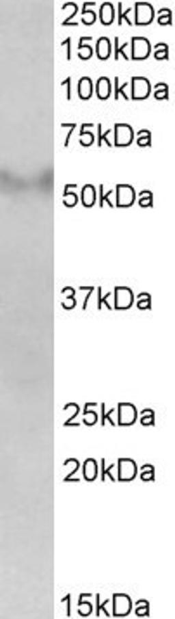 45-639 (2ug/ml) staining of Human Frontal Cortex lysate (35ug protein in RIPA buffer). Primary incubation was 1 hour. Detected by chemiluminescence.