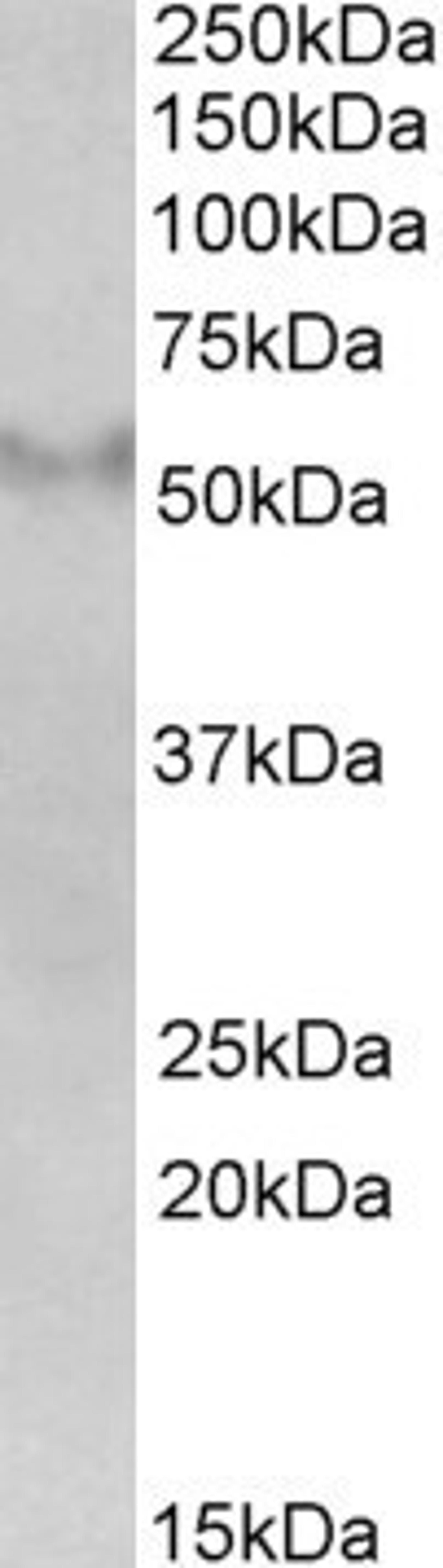 45-639 (2ug/ml) staining of Human Frontal Cortex lysate (35ug protein in RIPA buffer). Primary incubation was 1 hour. Detected by chemiluminescence.