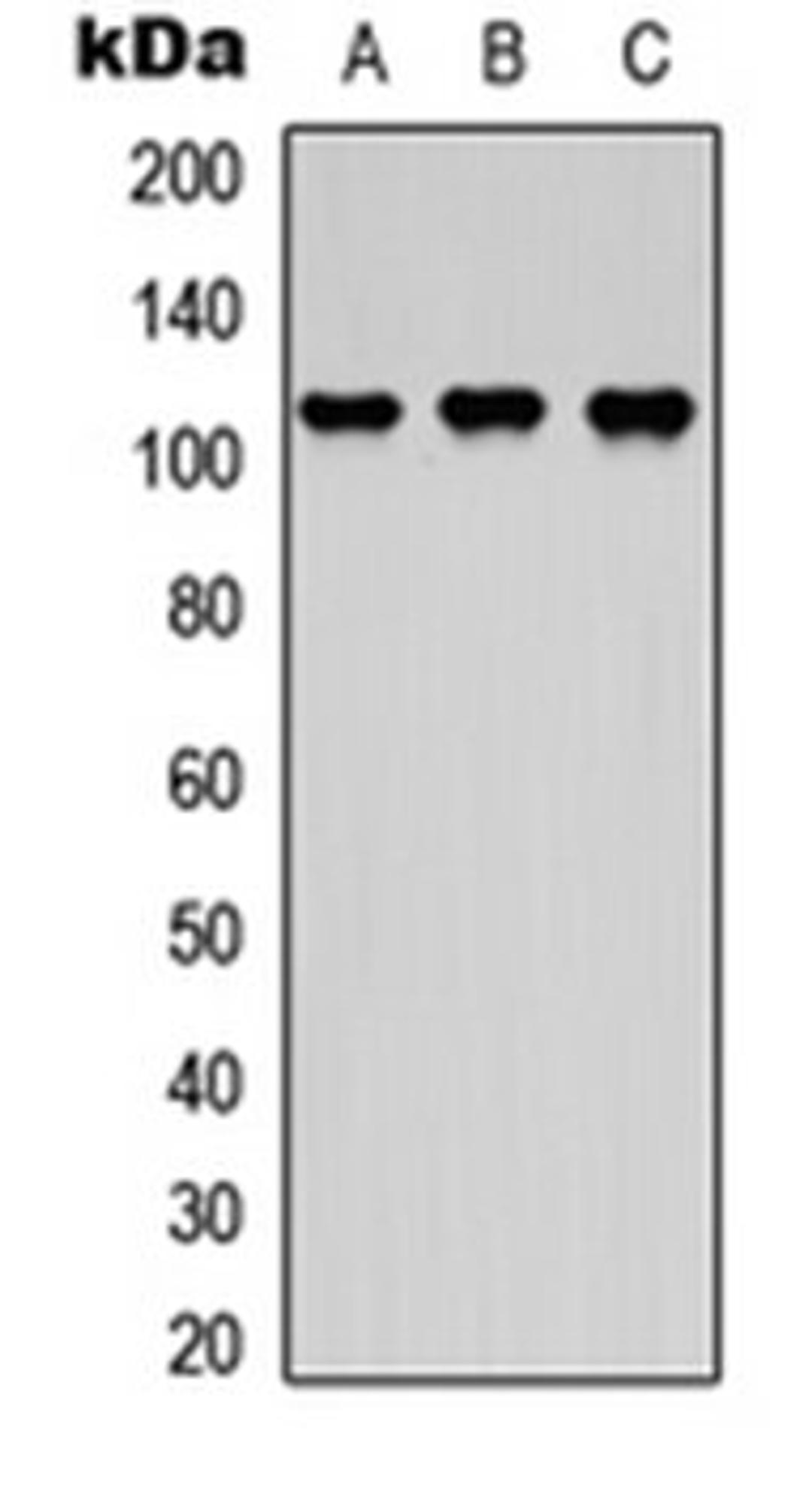 Western blot analysis of HEK293T (Lane 1), NS-1 (Lane 2), H9C2 (Lane 3) whole cell lysates using DDEF2 antibody