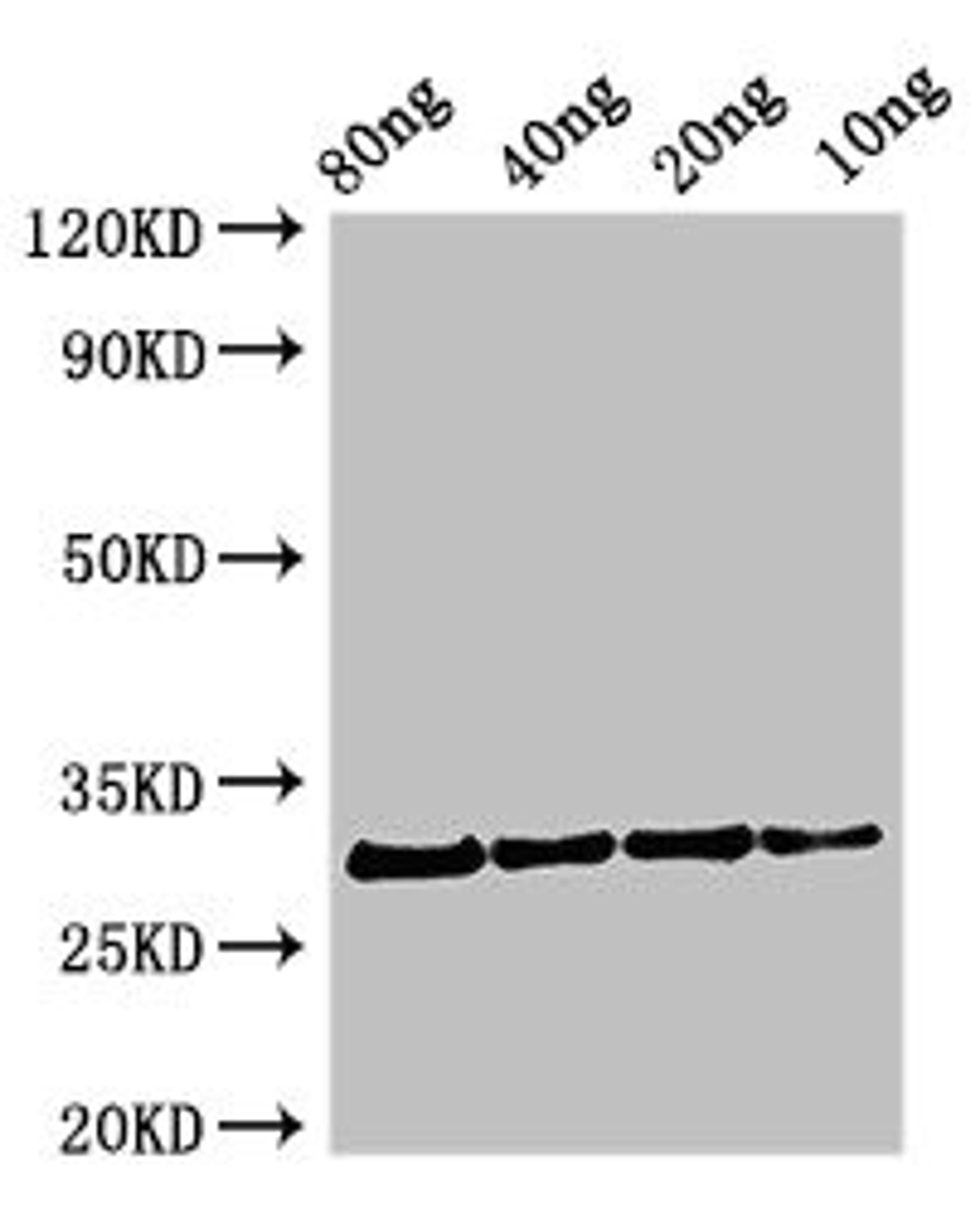 Western Blot. Positive WB detected in Recombinant protein. All lanes: Profilin antibody at 2.7µg/ml. Secondary. Goat polyclonal to rabbit IgG at 1/50000 dilution. Predicted band size: 31 kDa. Observed band size: 31 kDa